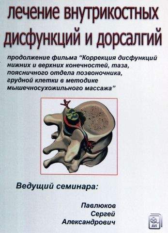 Дорсалгия поясничного отдела позвоночника что это. Лечение дорсалгии. Дорсалгии поясничного отдела. Хроническая дорсалгия поясничного отдела. Симптомы при дорсалгии.